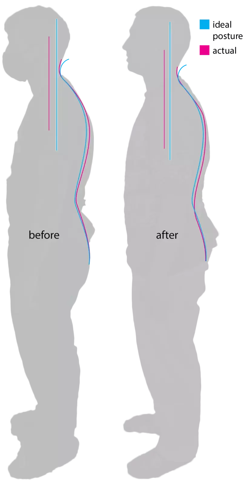Side-view before-and-after posture images comparing spinal alignment and body posture changes over time.